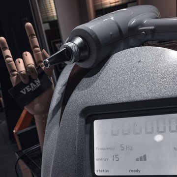 Видалення тату в Дніпрі