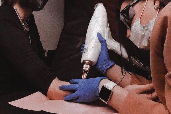 Видалення тату у Полтаві