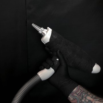 Видалення тату в Кременчуці