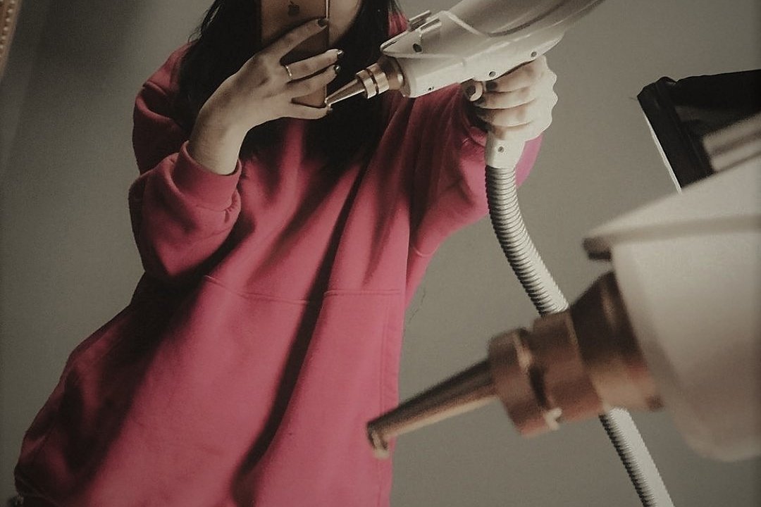 Видалення тату у Сумах