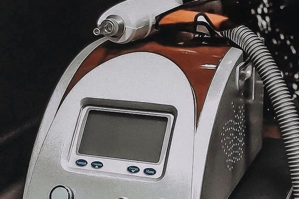 Видалення татуажу в Умані