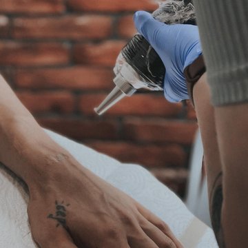 Видалення тату в Києві