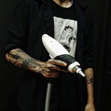 Видалення тату в Кременчуці