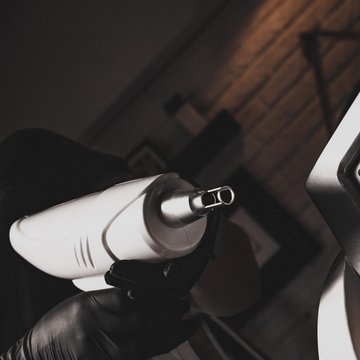 Видалення татуажу в Києві