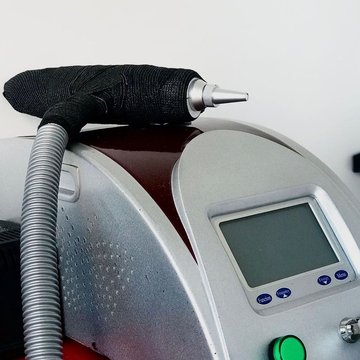 Видалення татуажу в Черкасах