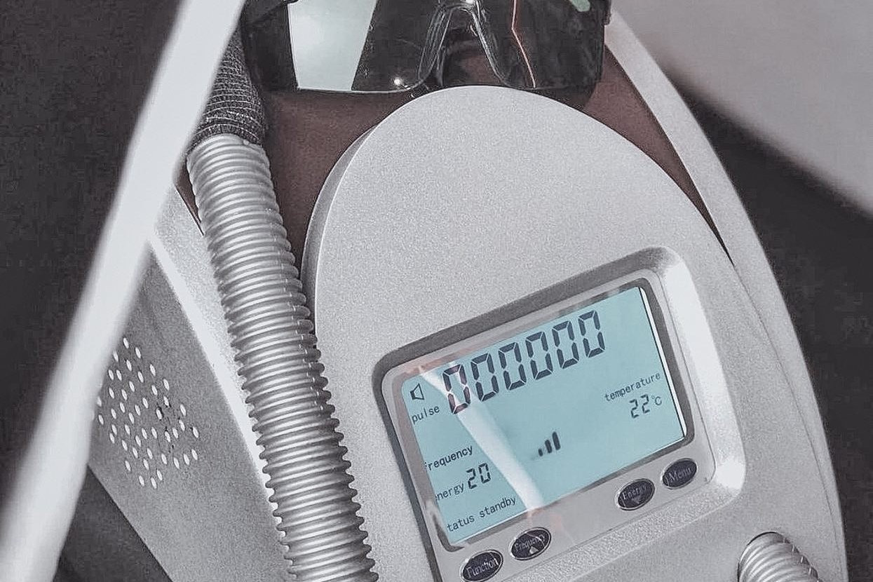 Видалення татуажу в Києві