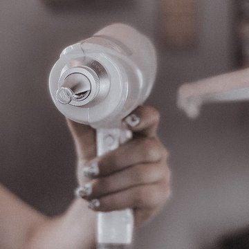 Видалення тату в Києві