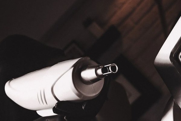 Видалення татуювання у Львові