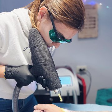 Видалення тату в Запоріжжі