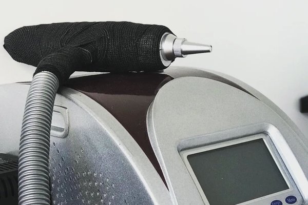 Видалення татуажу в Кременчуці