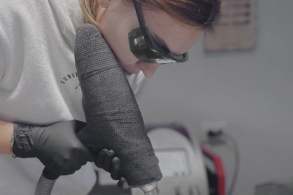 Видалення тату в Борисполі