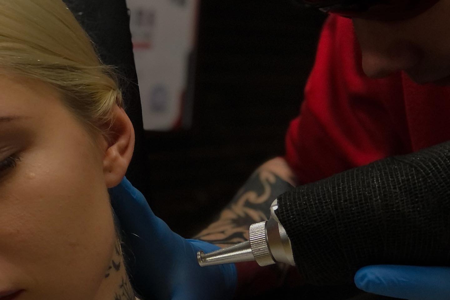 Видалення тату в Білій Церкві