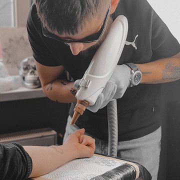 Видалення татуювання в Херсоні