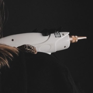 Видалення тату в Черкасах