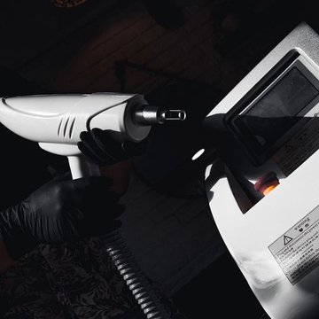 Видалення тату в Черкасах