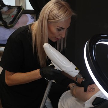 Видалення татуажу в Києві