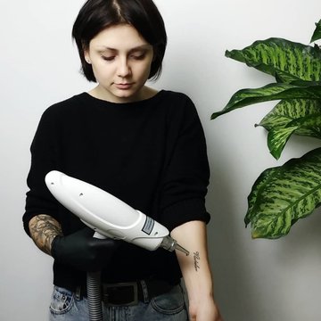Удаление татуировки в Харькове