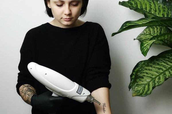 Удаление тату в Киеве