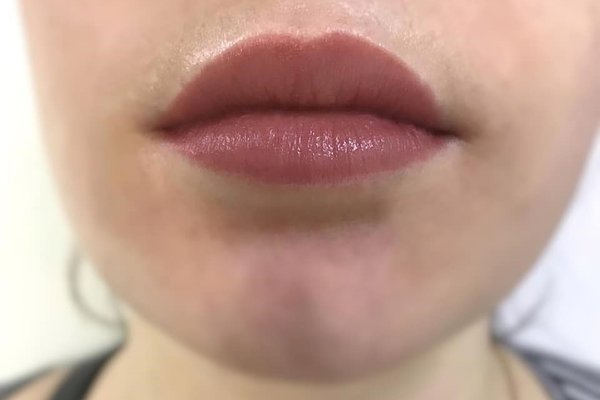 Удаление татуажа - только VeAn