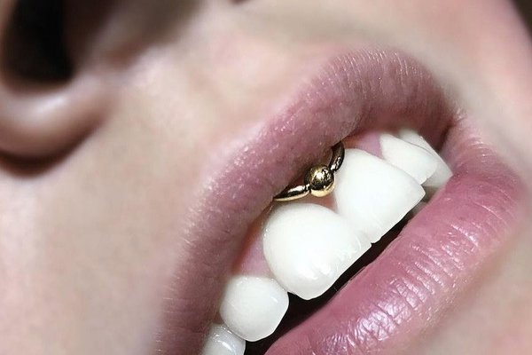 Пирсинг во рту смайл