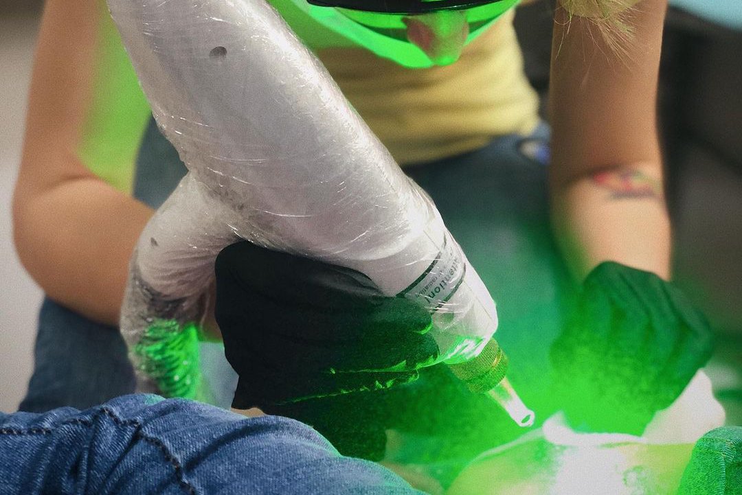 Удаление татуажа в Ужгороде