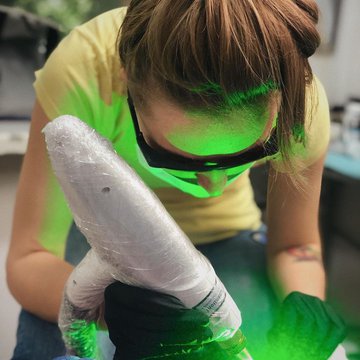 Видалення тату в Києві