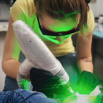 Удаление тату в киеве