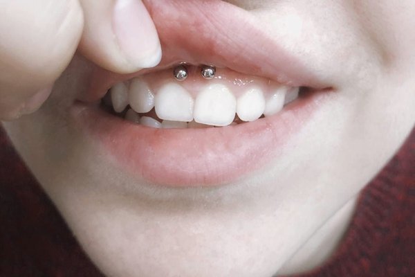 Пирсинг во рту смайл