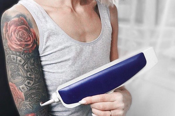 Удаление татуажа в Ивано-Франковске