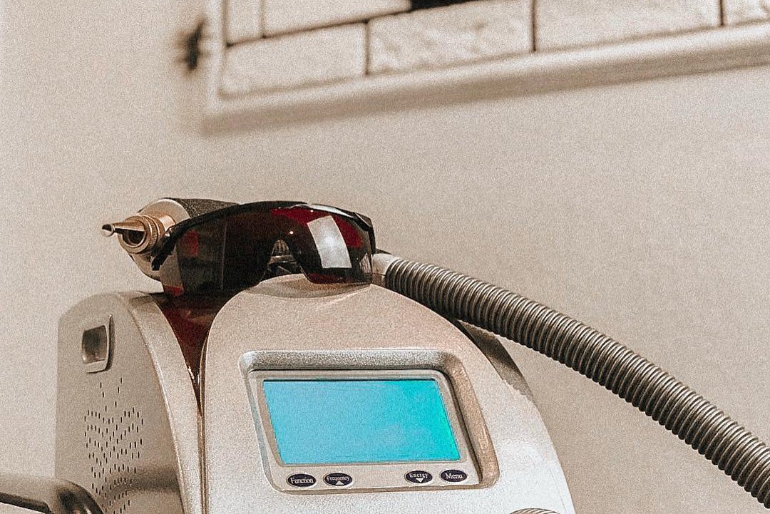 Видалення тату у Чернігові