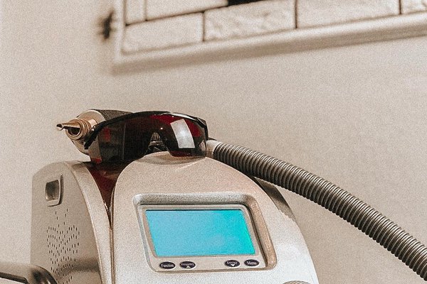 Преимущества удаления тату в "VeAn"