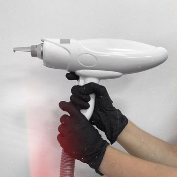 Видалення татуажу в Києві