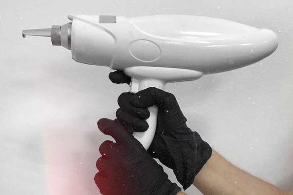 Удаление татуажа в Броварах