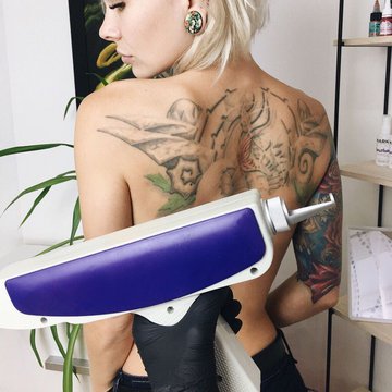 Удаление татуажа в Харькове