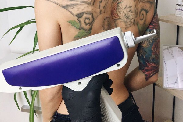 Эффективность лазерного удаления