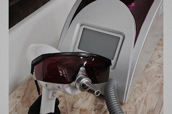 Видалення татуажу в Білій Церкві