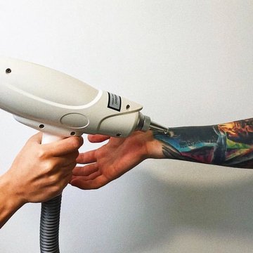 Видалення тату в Івано-Франківську