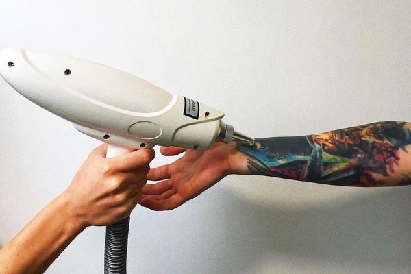 Преимущества лазера