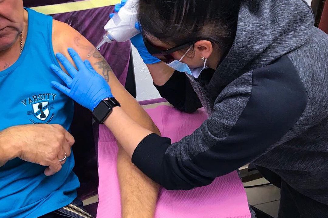 Удаление тату в Чернигове