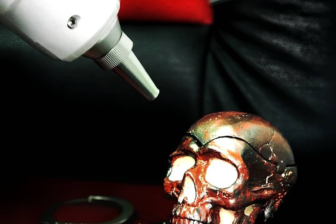 Видалення тату в Кропивницькому