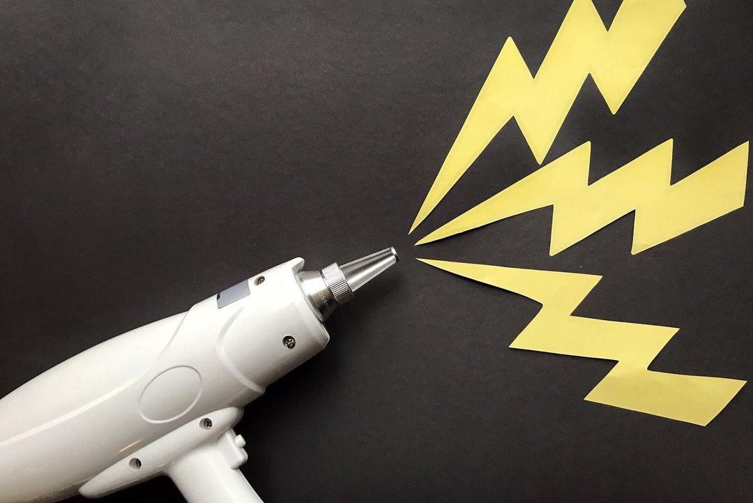 Удаление татуажа в Киеве