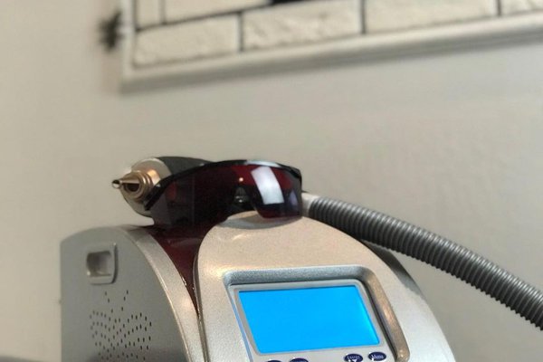 Удаление татуажа в Запорожье