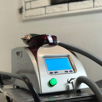 Видалення татуажу в Києві