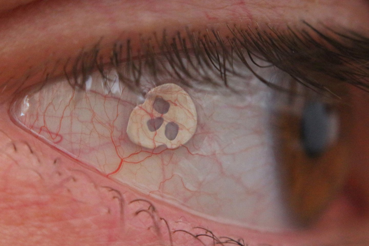 Пірсинг очей