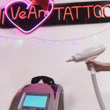 Видалення тату в Києві