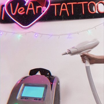 Удаление тату в Киеве