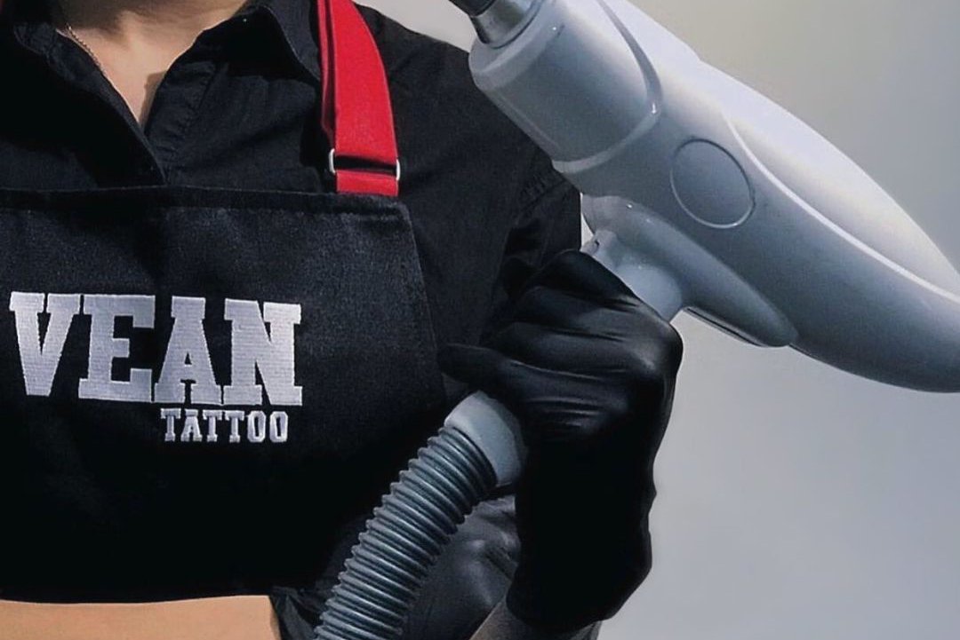 Удаление тату в Ужгороде