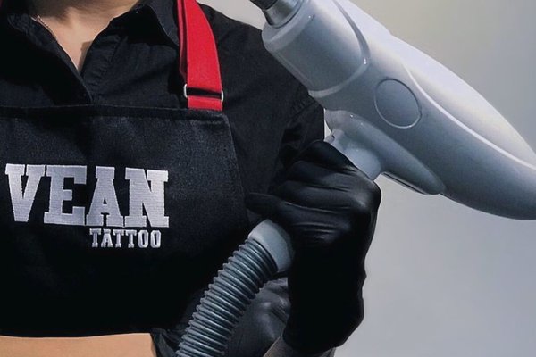 Удаление татуажа в Луцке