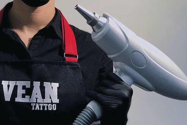 Удаления татуажа в Каменец-Подольском