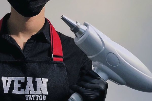 Удаление тату в Черкассах